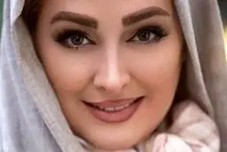 چهره قبل از عمل الهام حمیدی | این عکس خانم بازیگر همه را شوکه کرد