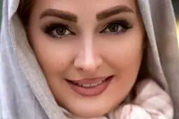چهره قبل از عمل الهام حمیدی | این عکس خانم بازیگر همه را شوکه کرد