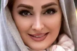 چهره قبل از عمل الهام حمیدی | این عکس خانم بازیگر همه را شوکه کرد