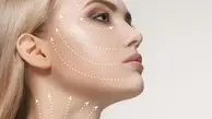 عمل جراحی لیفت صورت از چه سنی مناسب است؟