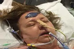  بیماری "سپتسمی"   |  برش کاغذی دست و پای این زن را گرفت +عکس