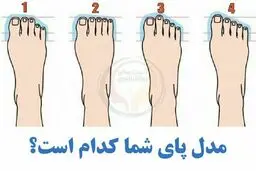 تست شخصیت شناسی |  با این تست متوجه شو که بدن سالمی داری یا نه! | با یک نگاه کردن کل شخصیتت رو میفهمی + پاسخ