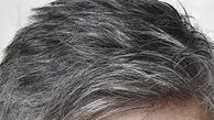 آیا می‌توان از سفید شدن موها پیشگیری کرد؟| موهای سفید دوباره سیاه می شوند