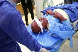 
افزایش ۴۷ درصدی مصدومان چهارشنبه سوری
