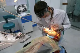 خدمات دندان پزشکی تامین اجتماعی چه خدماتی را پوشش داد؟ | خدمات تامین اجتماعی 
