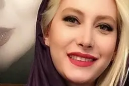 عکس لو رفته از چهره قبل عمل ” خانم بازیگر”