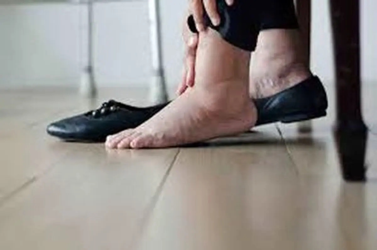 تجمع مایعات در بدن بسیار خطرناک است! | عوارض آن را بشناسید