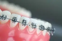 ارتودنسی؛ هنر چیدن دندان‌ها | عجیب‌ترین کیسی که ارتودنتیست‌ها حل کرده‌اند