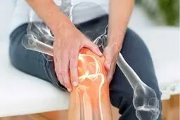 اولین علائم پوکی استخوان+ درمان