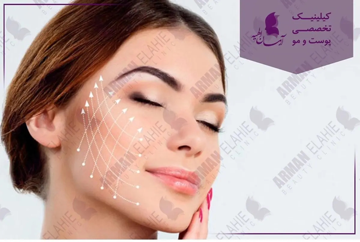 لیفت با نخ روش عالی برای جلوگیری از چین و چروک صورت