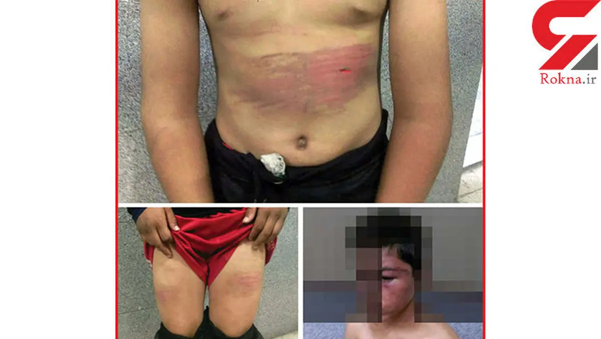 عکس های تکاندهنده از شکنجه پسر12 ساله در اتاق وحشت! / در مشهد فاش شد