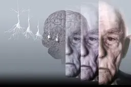 ابتلا به "زوال عقل" با افزایش اندک آلودگی هوا