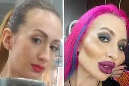 این زن بزرگ ترین گونه‌های دنیا رو داره! + تصویر