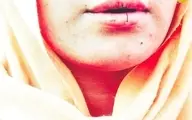 چند زن افغان لبهایشان را دوختند