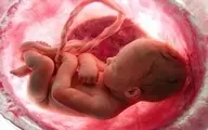 سقط جنین با افزایش خطر مرگ زودهنگام مرتبط است