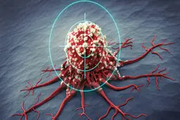 علایم و درمان سومین سرطان شایع زنان | مردان هم می‌توانند واکسن HPV بزنند