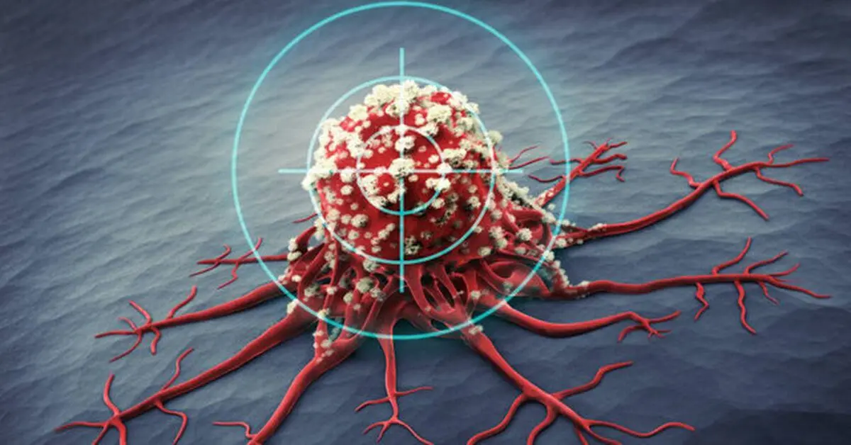 علایم و درمان سومین سرطان شایع زنان | مردان هم می‌توانند واکسن HPV بزنند