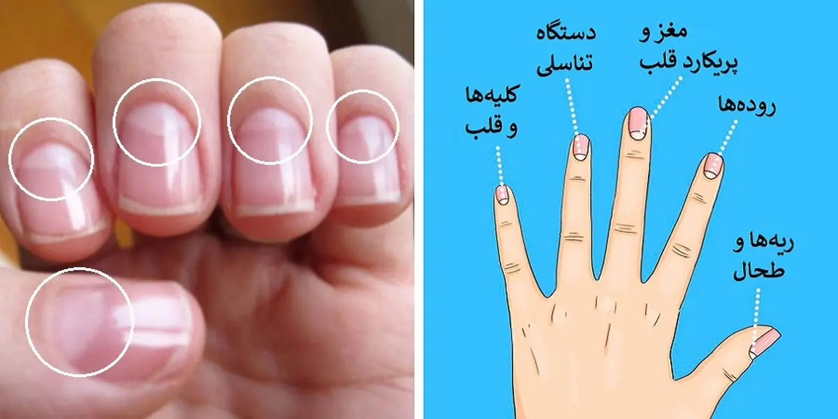  بروز 13مشکل جسمی که روی هلال ناخن ها