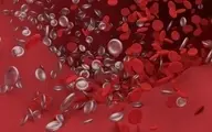 نتیجه یک مطالعه جدید: آنتی‌بادی‌های سرکش در مبتلایان به کرونا، لخته‌های خون ایجاد می‌کند