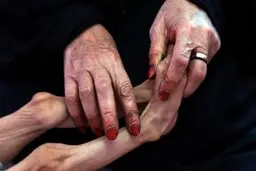 میزان گرسنگی در یمن امسال پنج برابر شود 