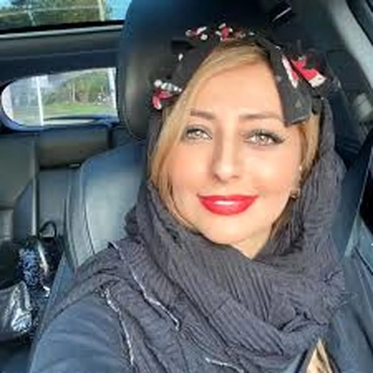 نفیسه روشن قبل و بعد از عمل زیبایی + عکس جنجالی