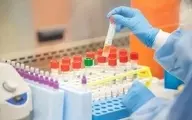 
وزارت بهداشت  |   کیت ایرانی آزمایش تشخیصی سریع کرونا ساخته شد
