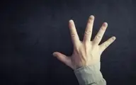 کدوم نوع تغییر شکل انگشتان دست، خطرناکه؟