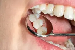 توصیه های مراقبتی مهم درباره سلامت دهان و دندان به دیابتی ها | دیابتی ها بخوانند!