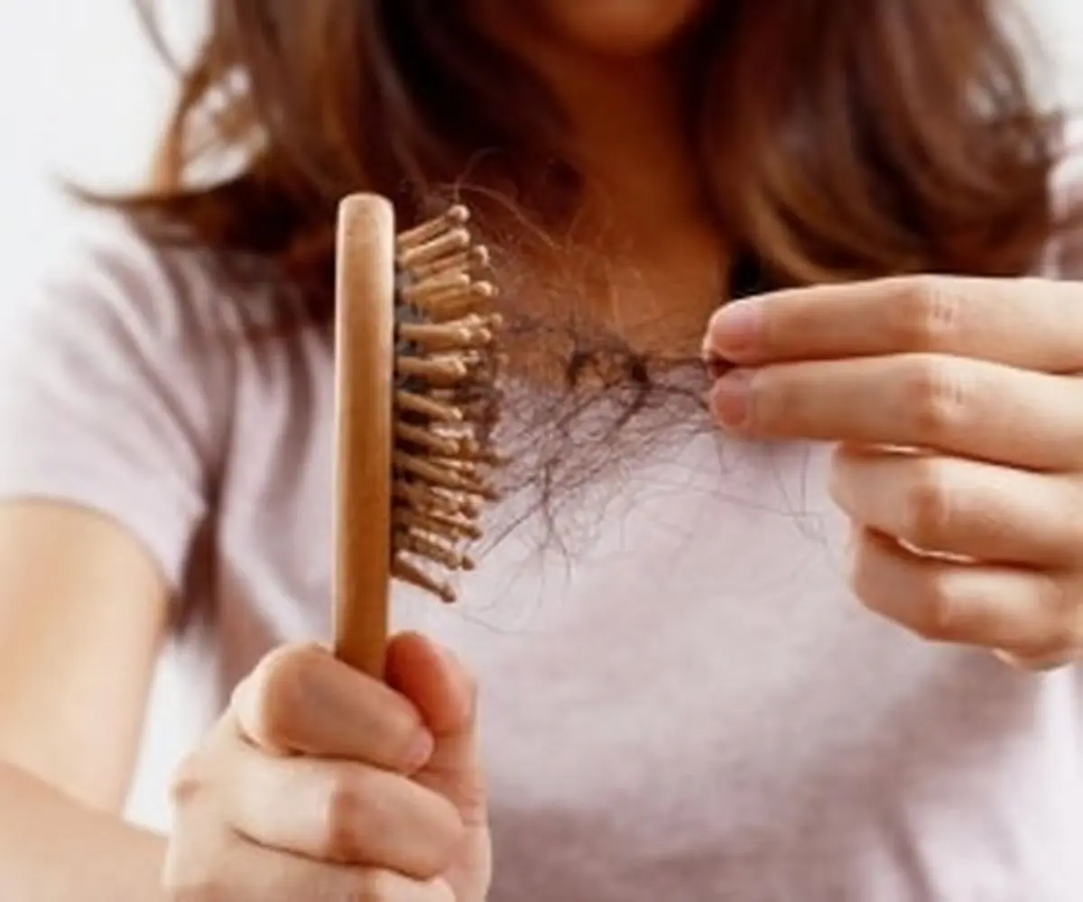 حقایق مهم درباره ریزش موی کرونایی 
