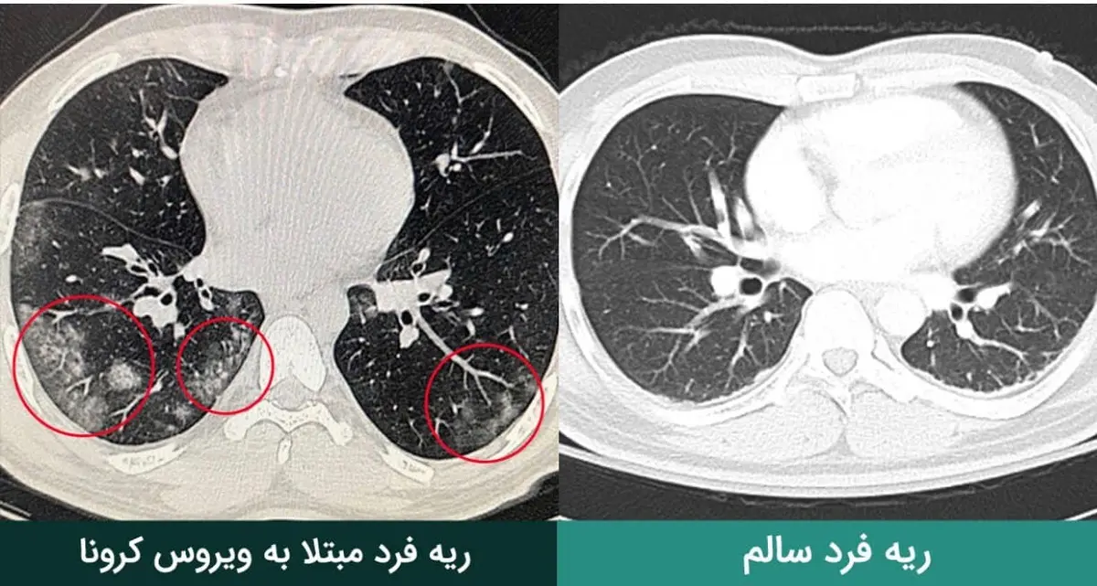  علائم خطرناک  |  باید سی‌تی‌اسکن بگیرید 