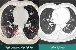  علائم خطرناک  |  باید سی‌تی‌اسکن بگیرید 