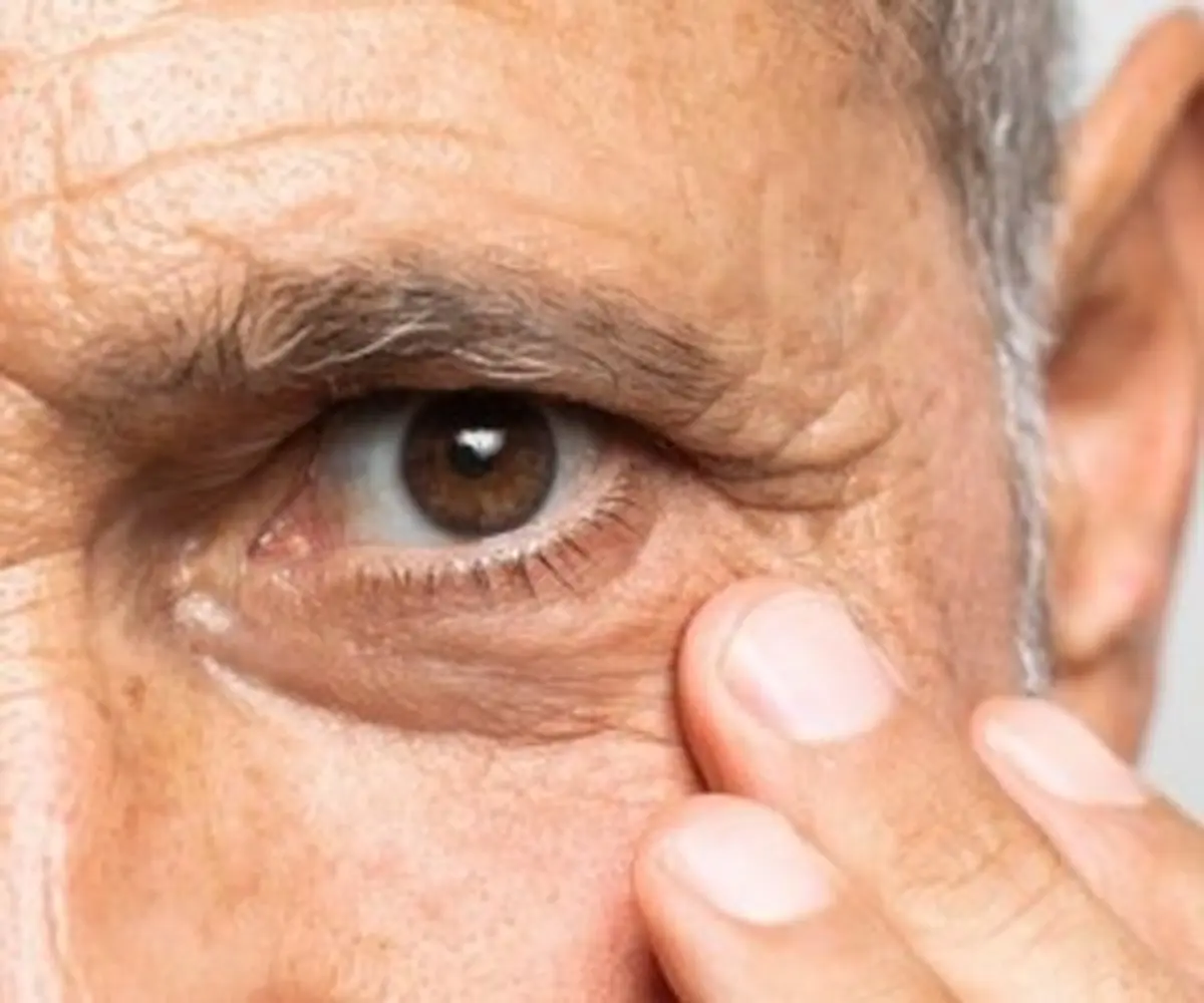 ارتباط روده و گوارش با انواع بیماری چشم