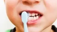 درمان‌های باورنکردنی برای سفید کردن دندان در خانه