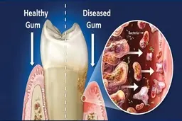  کشف اصلی‌ترین دلیل مرگبار شدن ویروس کرونا 