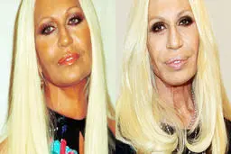 هنرپیشه های هالیوودی که با جراحی پلاستیک چهره خود را خراب کردند