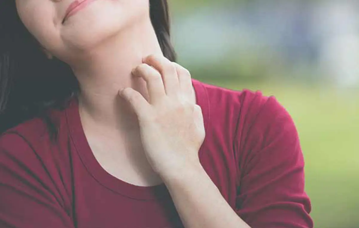 اگزما پوستی چیست؛ چه علائمی دارد و برای درمان اگزما چه باید کرد؟