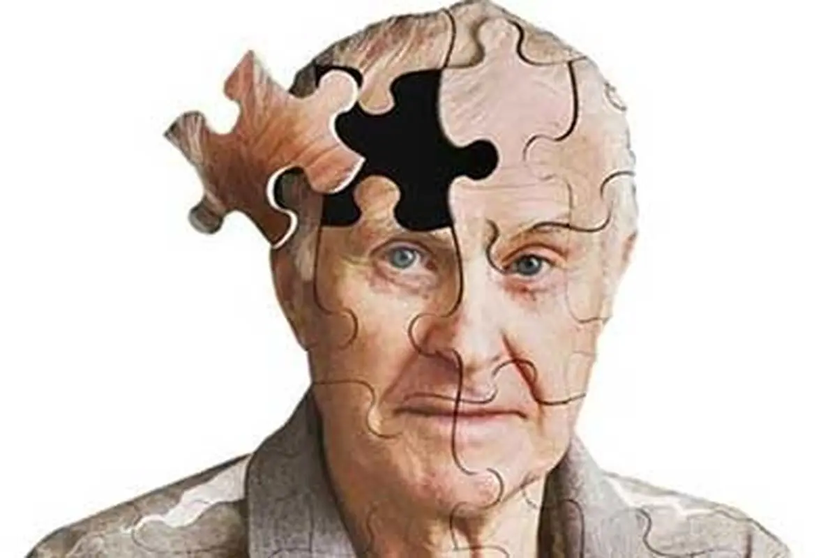 کلید مخفی درمان آلزایمر کشف شد