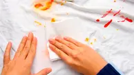 اگر ناخن هات یا لباست  با زردچوبه  رنگ گرفته با این ترفند از بین ببرش | راهکاری ساده برای از بین بردن لکه زرد چوبه از روی اجسام و دست