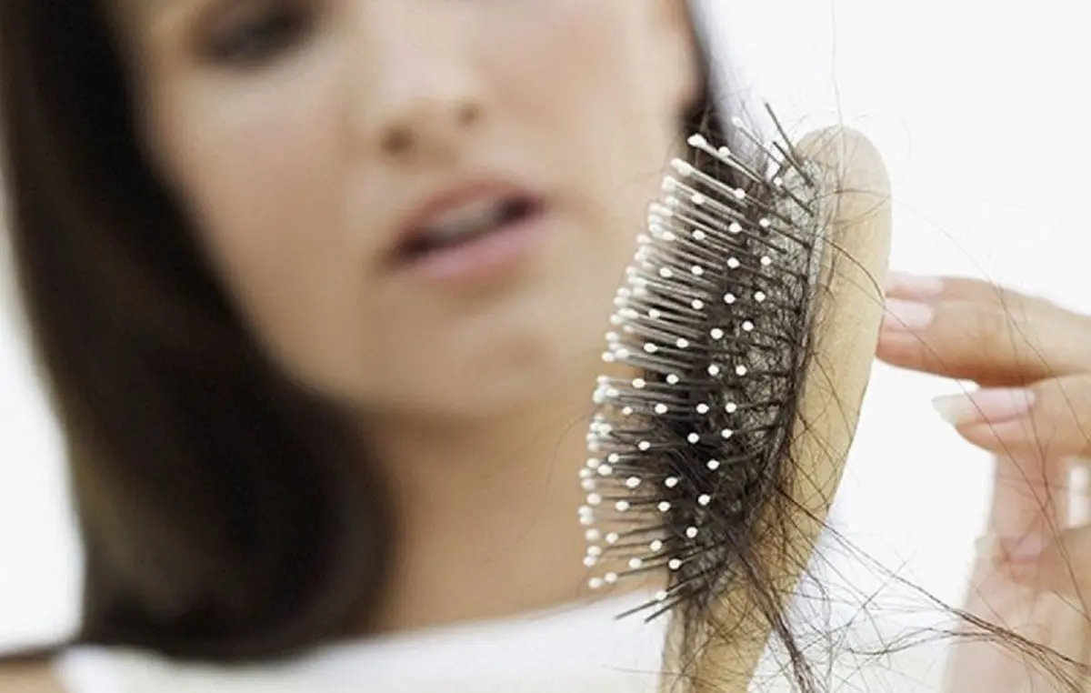 جلوگیری از ریزش مو با این دو ویتامین | ترکیب این ویتامین ها معجزه می کند + جزئیات