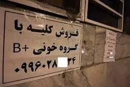 تشویق سیاست مداران به فروش کلیه | چه ایرادی دارد هر ایرانی یک کلیه داشته باشد ؟ 