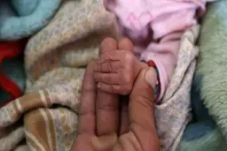 سوءتغذیه پس از کرونا همه گیر می شود 