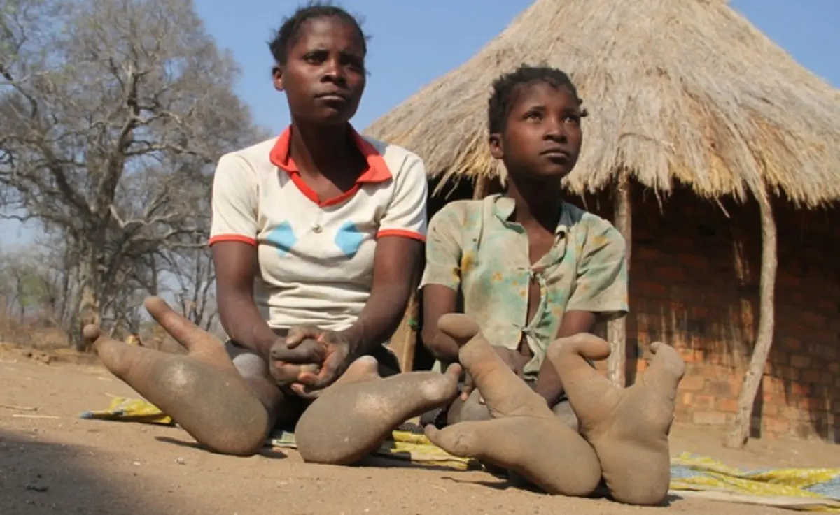 یک قبیله آفریقایی با پاهای عجیب و غریب اما واقعی!+تصویر