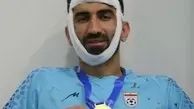 لحظه وحشتناک شکستن فَکِ علیرضا بیرانوند + فیلم