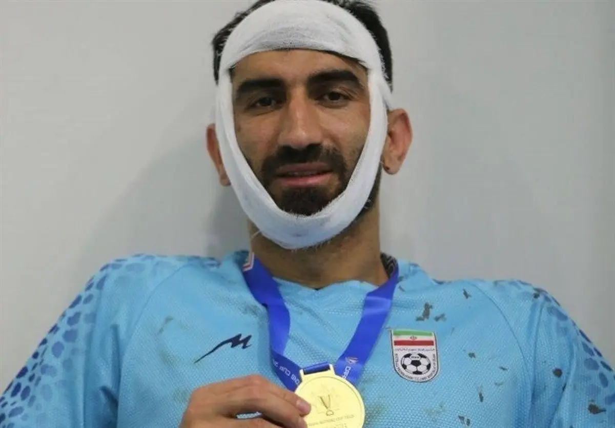 لحظه وحشتناک شکستن فَکِ علیرضا بیرانوند + فیلم