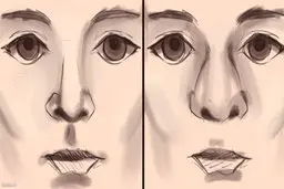 آمار عجیب جراحی بینی | عمل زیبایی در مردان بیشتر است یا زنان؟ | مردان ایرانی گوی سبقت را از زنان ربودند!