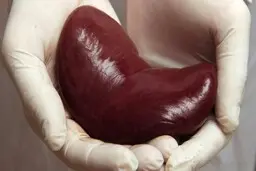 فروش کلیه مادر و کودک توسط پدر خانواده ! + سرنوشت تلخ