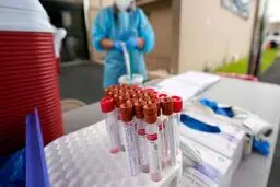
پس از اینکه فرد کرونا گرفت، آنتی‌بادی‌ها دست کم ۳ ماه در بدن او باقی می‌مانند
