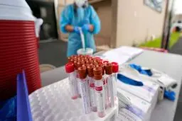 
پس از اینکه فرد کرونا گرفت، آنتی‌بادی‌ها دست کم ۳ ماه در بدن او باقی می‌مانند

