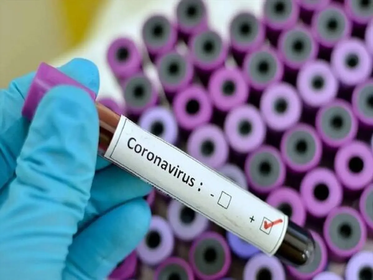 متن و حاشیه انتشار نامه جعلی در مورد ویروس کرونا 