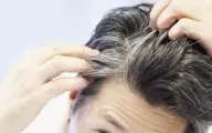 با این ترفند از سفید شدن موهای خود جلوگیری کنید!
